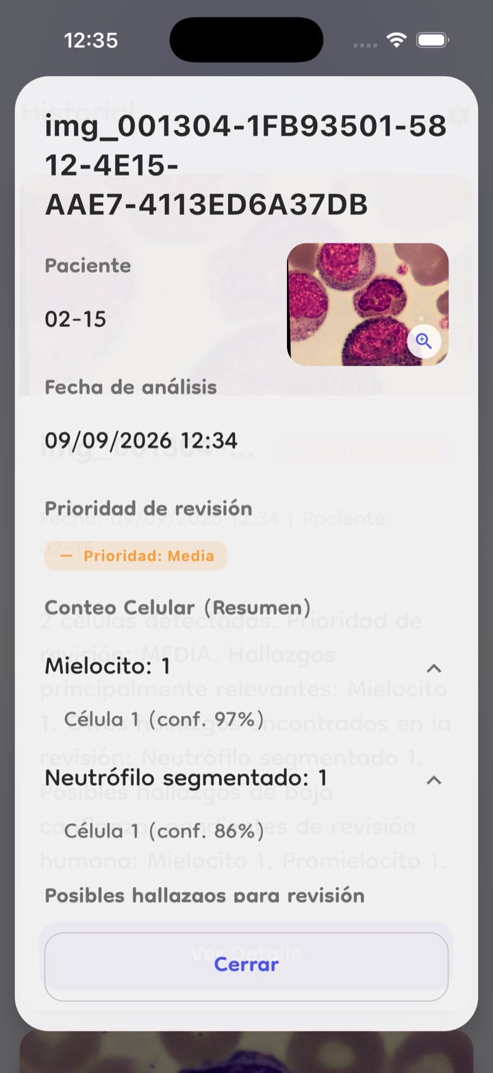 Resultado del análisis con el conteo por tipo celular y el distintivo de prioridad